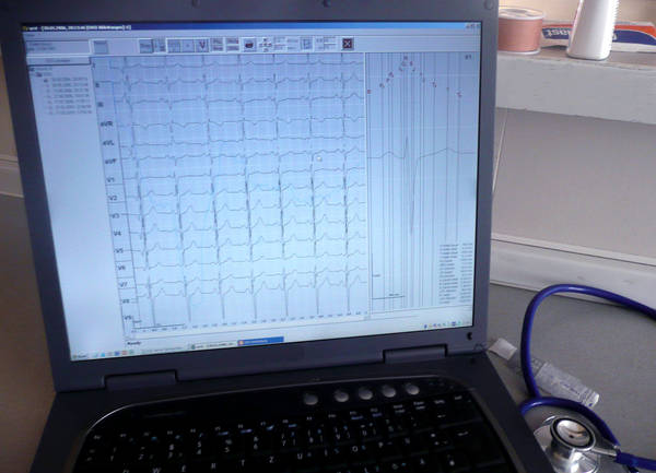 ECG laptop with telemonitoring